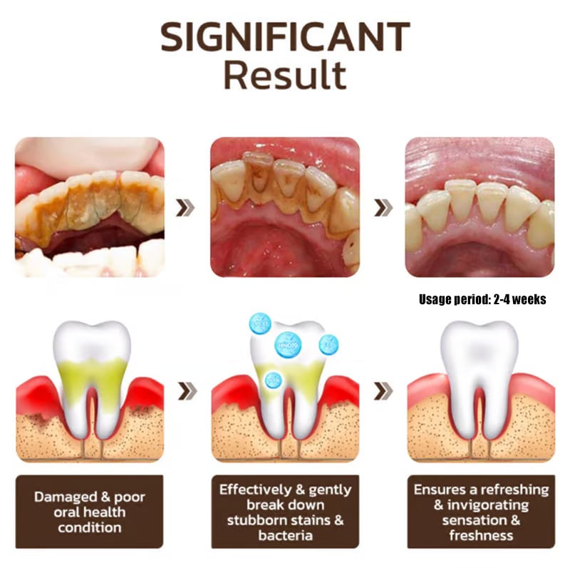 โจ Achieve a Radiant Smile - ๐ฆท Niacinamide Whitening Toothpaste - For Healthier, Whiter Teeth!