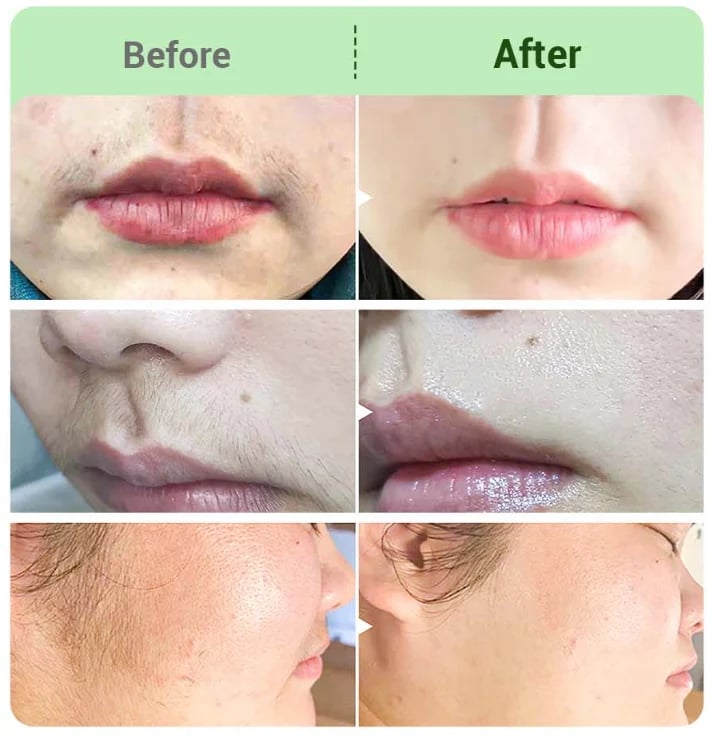 🤩Hair Removal Cream Kit for Women🤩