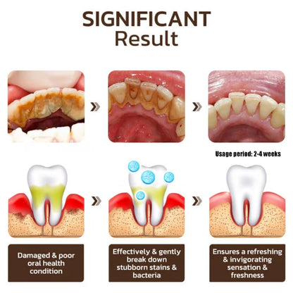 ✨ Achieve a Radiant Smile - 🦷 Niacinamide Whitening Toothpaste - For Healthier, Whiter Teeth!